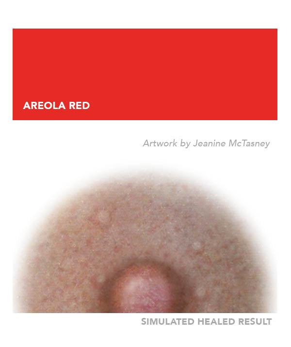 Areola Red