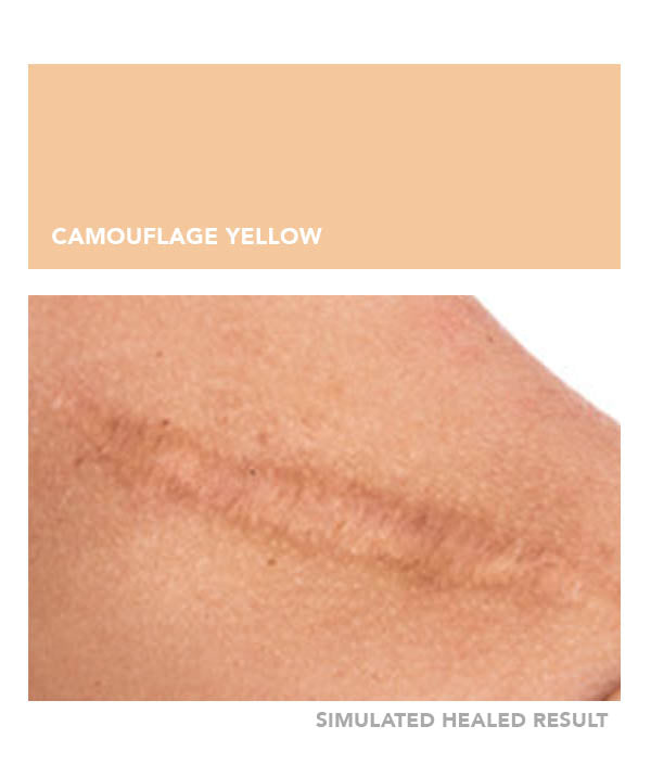 Camouflage Yellow