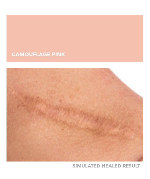 Camouflage Pink