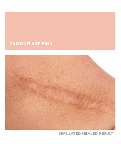 Camouflage Pink