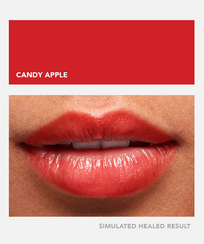 Candy Apple