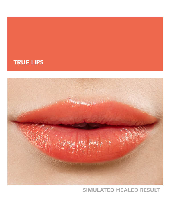 True Lips